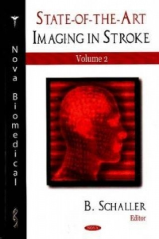 Carte State-of-the-Art Imaging in Stroke 