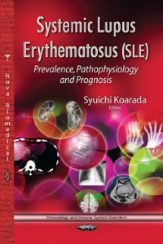 Kniha Systemic Lupus Erythematosus (SLE) 