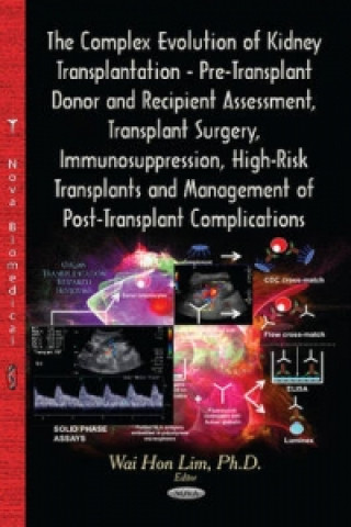Książka Complex Evolution of Kidney Transplantation 