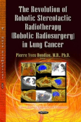 Knjiga Revolution of Robotic Stereotactic Radiotherapy (Robotic Radiosurgery) in Lung Cancer 