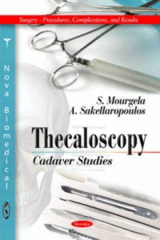 Libro Thecaloscopy A. Sakellaropoulos