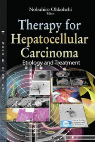 Knjiga Therapy for Hepatocellular Carcinoma 