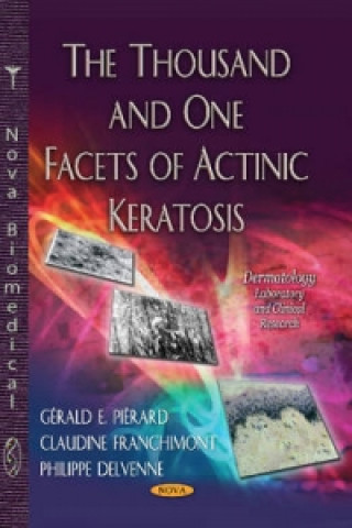 Könyv Thousand & One Facets of Actinic Keratosis 