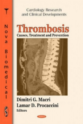 Book Thrombosis 