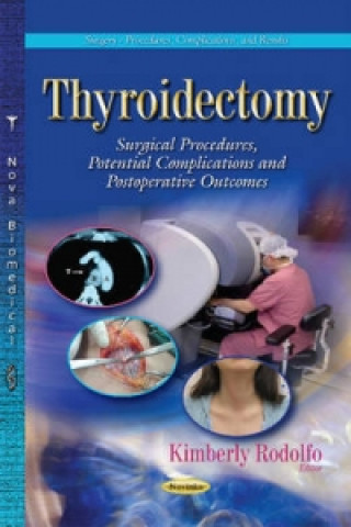 Kniha Thyroidectomy Kimberly Rodolfo