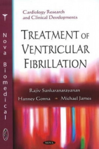 Książka Treatment of Ventricular Fibrillation Michael James