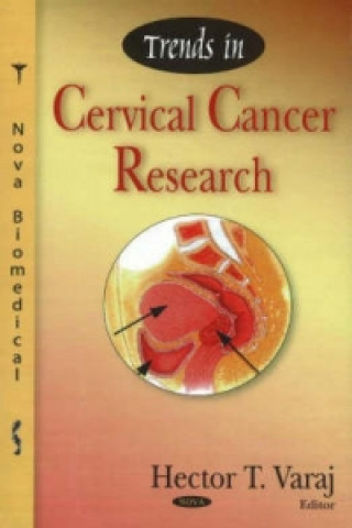 Carte Trends in Cervical Cancer Research 