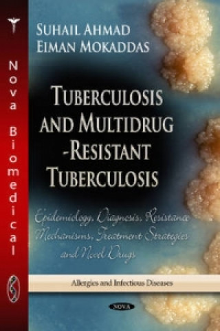 Könyv Tuberculosis & Multidrug-Resistant Tuberculosis 