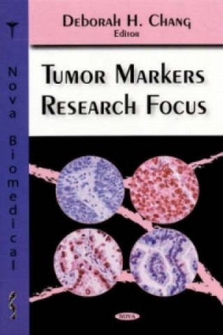 Książka Tumor Markers Research Focus 