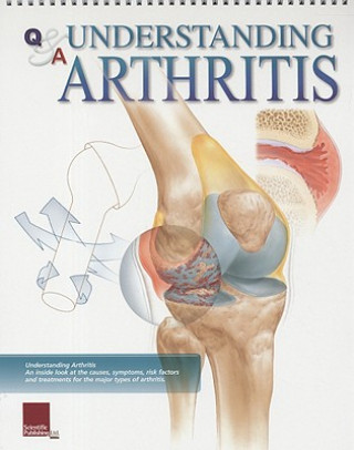 Kniha Understanding Arthritis Flip Chart Scientific Publishing