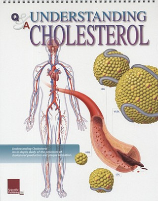 Carte Understanding Cholesterol Flip Chart Scientific Publishing