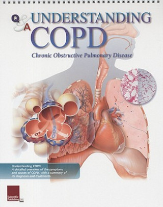 Kniha Understanding COPD Flip Chart Scientific Publishing