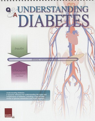 Książka Understanding Diabetes Flip Chart Scientific Publishing