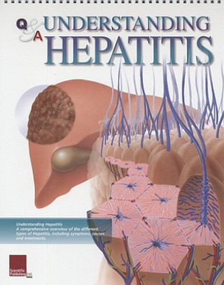 Carte Understanding Hepatitis Flip Chart Scientific Publishing