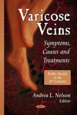 Книга Varicose Veins 