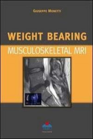 Kniha Weight Bearing Musculoskeletal MRI Giuseppe Monetti