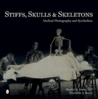Könyv Stiffs, Skulls and Skeletons Elizabeth A. Burns