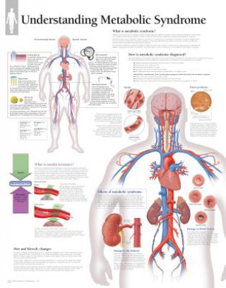 Tiskovina Understanding Metabolic Syndrome Laminated Poster Scientific Publishing