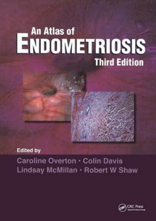 Book Atlas of ENDOMETRIOSIS Colin Davis