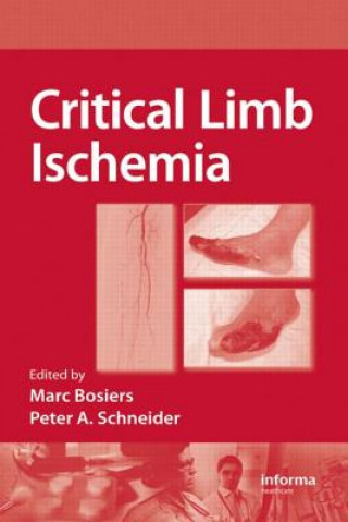 Carte Critical Limb Ischemia Marc Bosiers