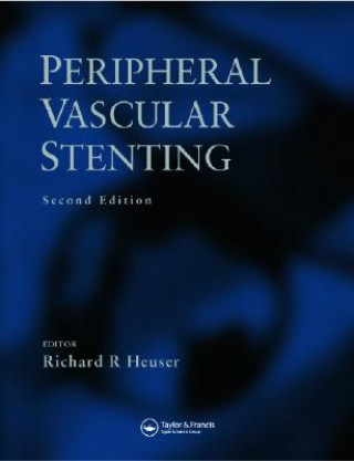 Knjiga Peripheral Vascular Stenting, Second Edition Richard R. Heuser