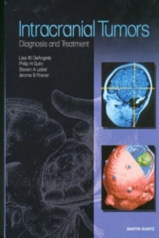 Книга Intracranial Tumors 