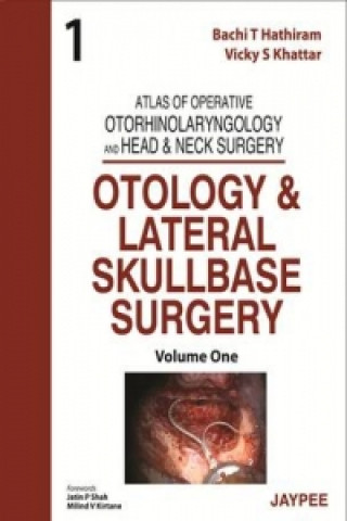 Buch Atlas of Operative Otorhinolaryngology and Head & Neck Surgery: Otology and Lateral Skullbase Surgery Vicky S. Khattar