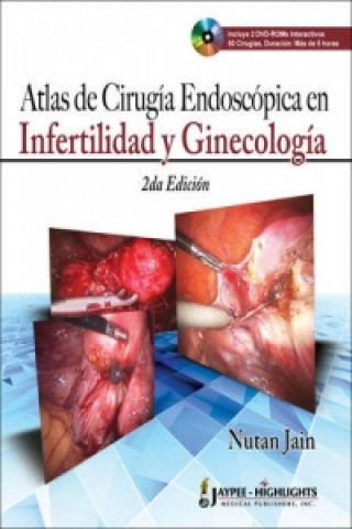 Kniha Atlas de Cirugia Endoscopica en Infertilidad y Ginecologica 2/E Nutan Jain