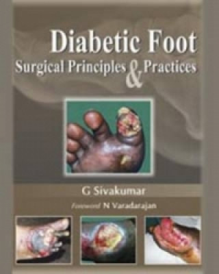 Carte Diabetic Foot G. Sivakumar