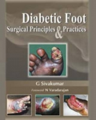 Libro Diabetic Foot G. Sivakumar