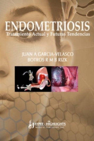 Könyv Endometriosis: Tratamiento Actual y Futuras Tendencias Botros R. M. B. Rizk