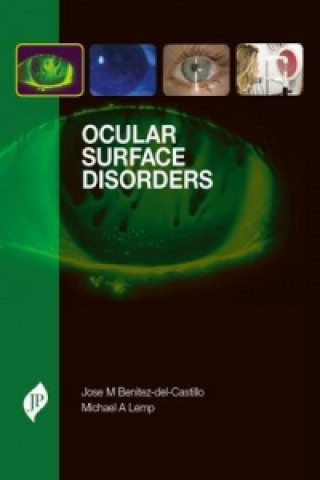 Book Ocular Surface Disorders Michael A. Lemp