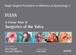 Book Single Surgical Procedures in Obstetrics and Gynaecology - Volume 1 - VULVA Pooja Gupta