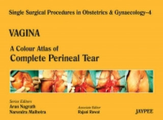 Carte Single Surgical Procedures in Obstetrics and Gynaecology - Volume 4 - VAGINA Rajani Rawat