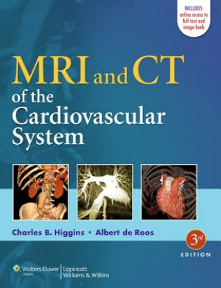 Könyv MRI and CT of the Cardiovascular System Albert de Roos