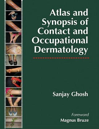 Livre Atlas and Synopsis of Contact and Occupational Dermatology Sanjay Ghosh