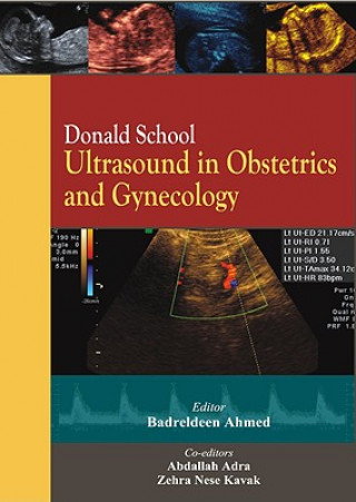 Könyv Donald School Ultrasound in Obstetrics and Gynecology Badreldeen Ahmed