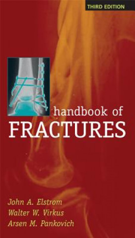 Kniha Handbook of Fractures, Third Edition Clayton R. Perry