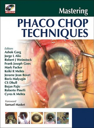 Könyv Mastering Phaco Chop Techniques Ashok Garg
