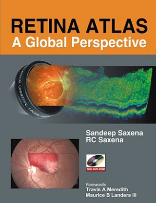 Kniha Retina Atlas: A Global Perspective R. C. Saxena