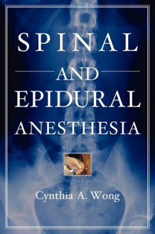Könyv Spinal and Epidural Anesthesia Cynthia Wong