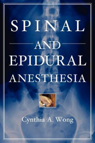 Kniha Spinal and Epidural Anesthesia Cynthia Wong