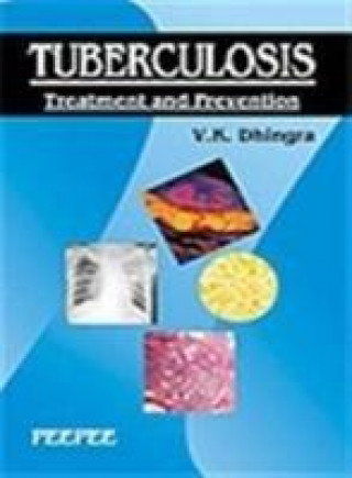 Livre Tuberculosis V.K. Dhingra