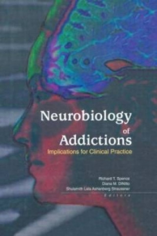 Carte Neurobiology of Addictions Diana M. DiNitto
