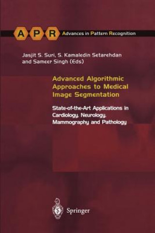 Kniha Advanced Algorithmic Approaches to Medical Image Segmentation S. Kamaledin Setarehdan