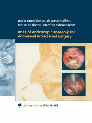 Kniha Atlas of Endoscopic Anatomy for Endonasal Intracranial Surgery Paolo Cappabianca