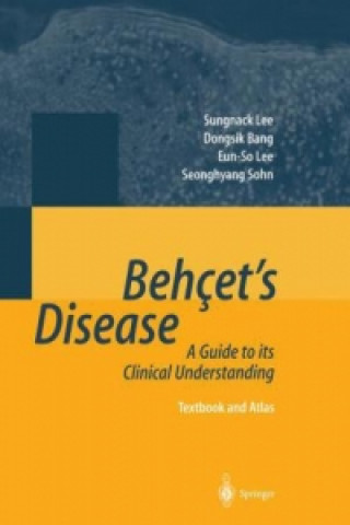 Knjiga Behcet's Disease Seonghyang Sohn