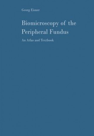 Carte Biomicroscopy of the Peripheral Fundus Georg Eisner