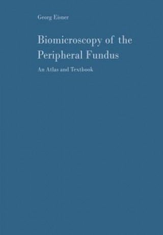 Kniha Biomicroscopy of the Peripheral Fundus Georg Eisner