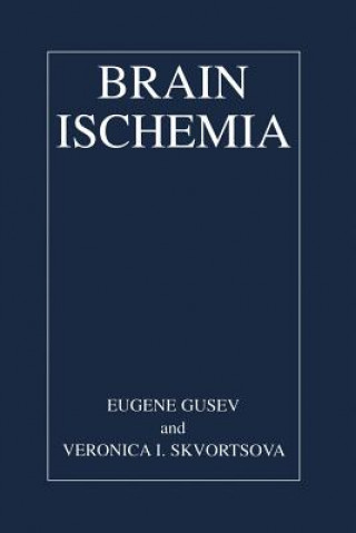 Książka Brain Ischemia Veronika I. Skvortsova